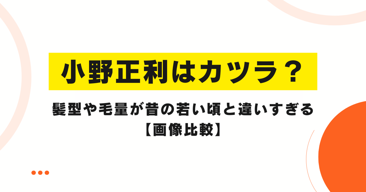 小野正利はカツラ？髪型や毛量が昔の若い頃と違いすぎる【画像比較】