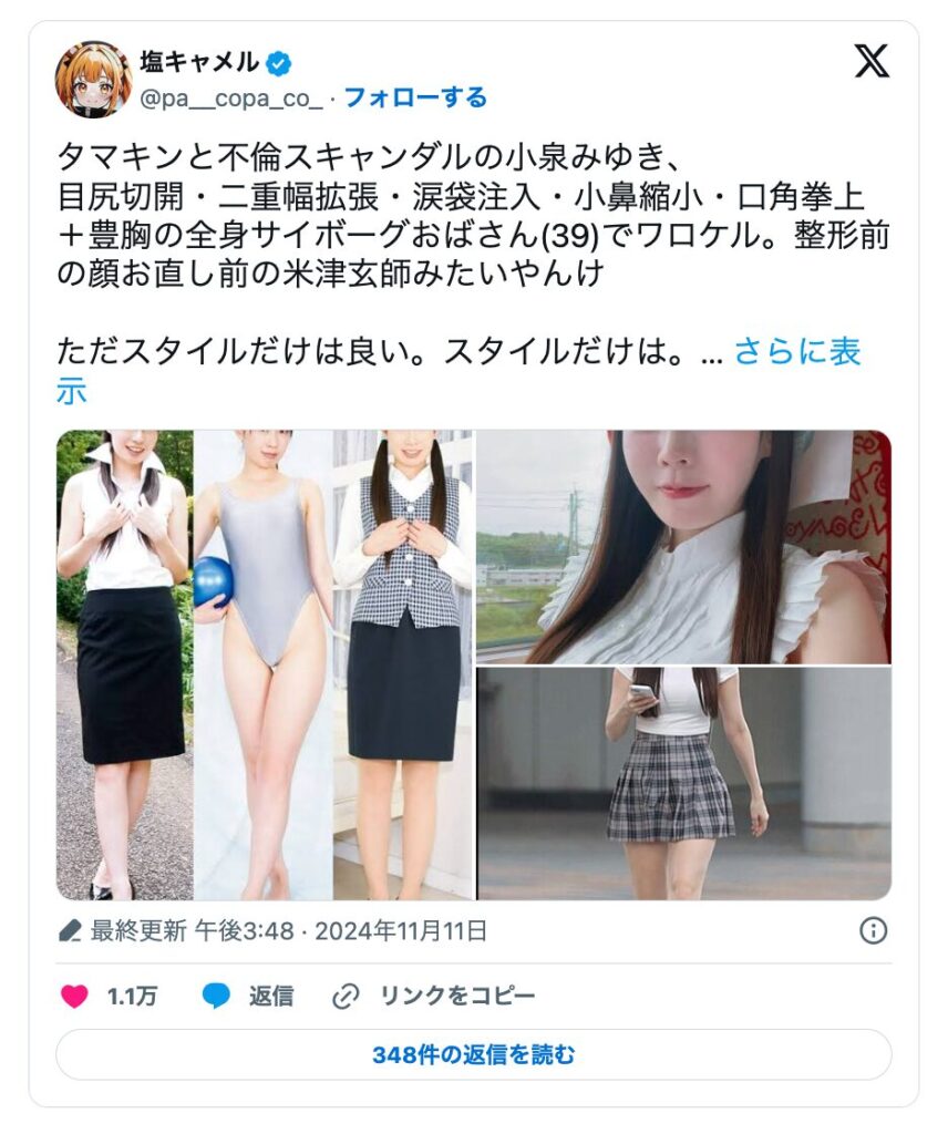 小泉みゆき　整形前