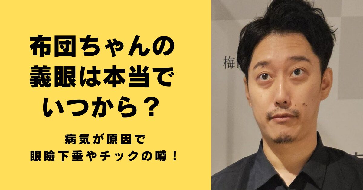 布団ちゃんの義眼は本当でいつから？病気が原因で眼瞼下垂やチックの噂！