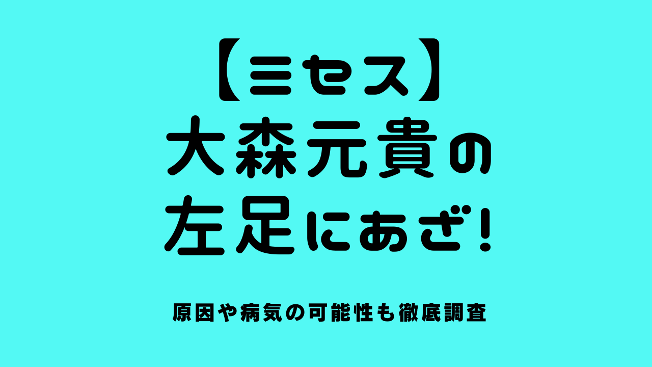 【ミセス】大森元貴の左足にあざ！原因や病気の可能性も徹底調査